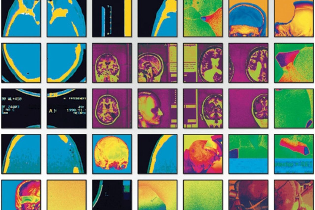 Custombone+pediatrico