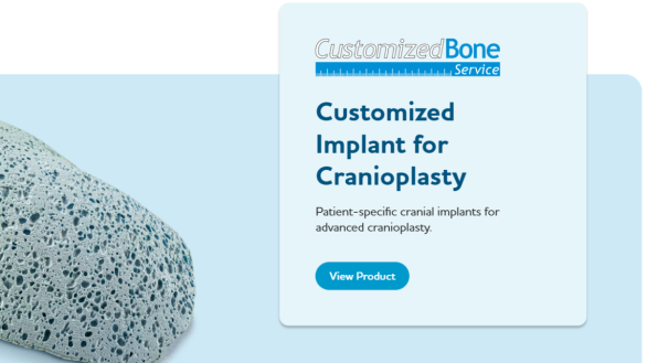 Why to choose CustomizedBone?