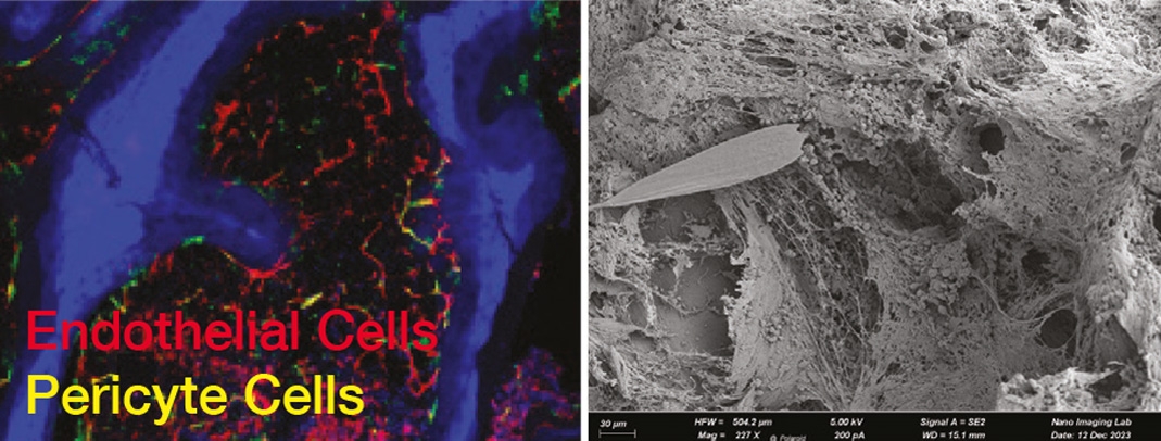 Human bone marrow