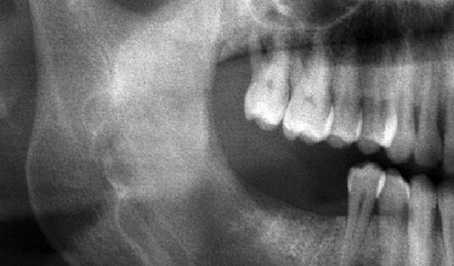 dentale e maxillo-facciale