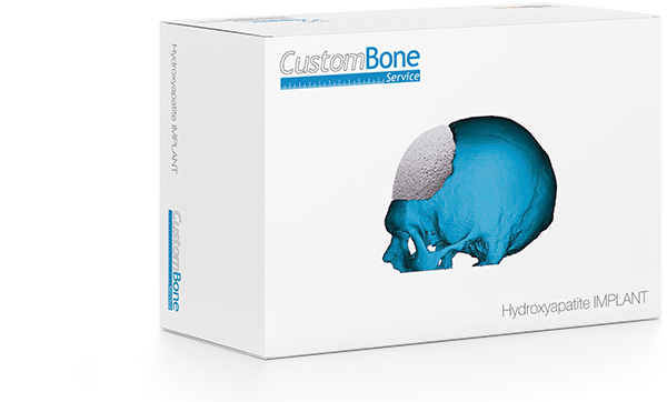 CustomBone Service-dispositivo su misura per cranioplastica